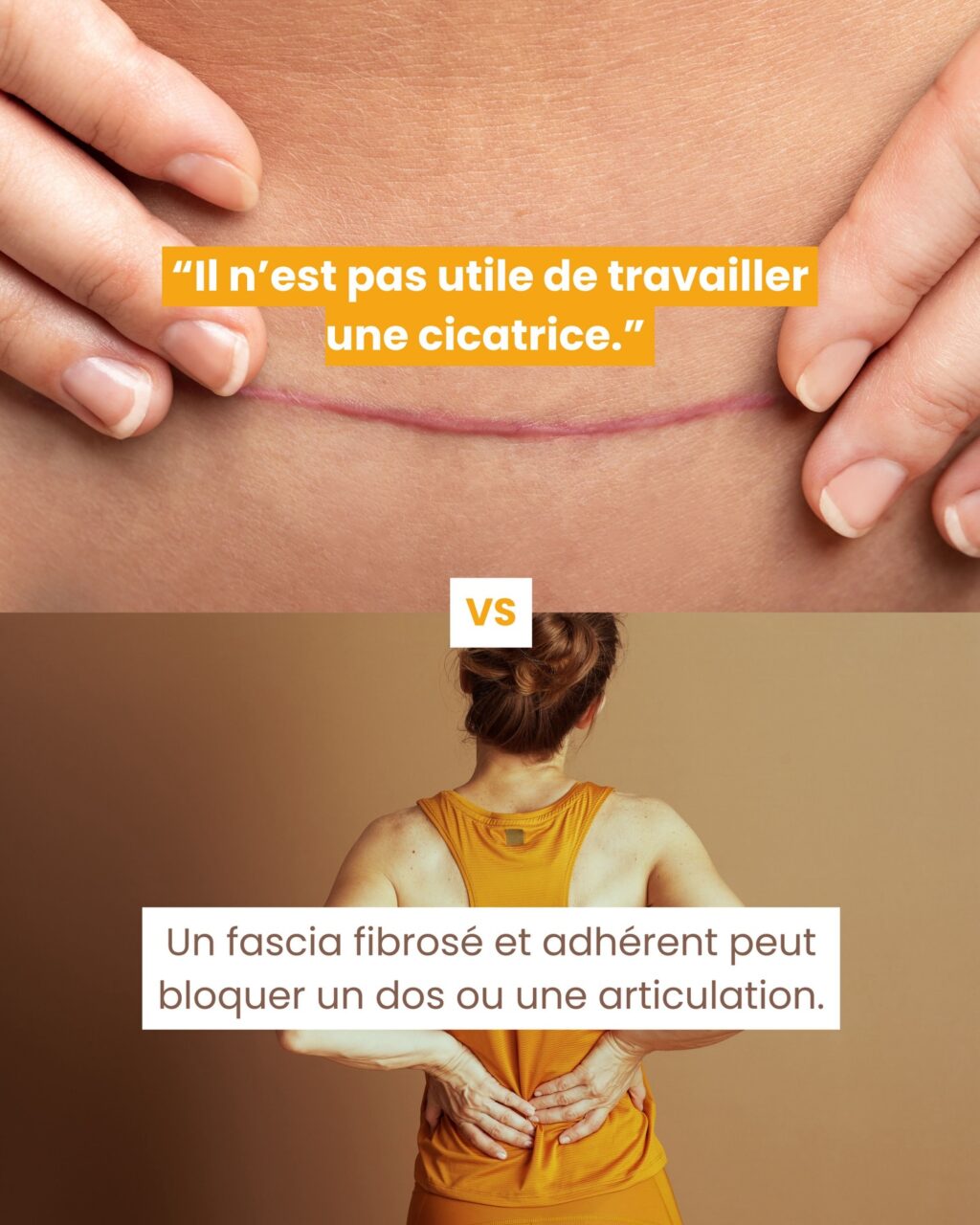 Instagram post from fascia_byclara. This post is in position 2.